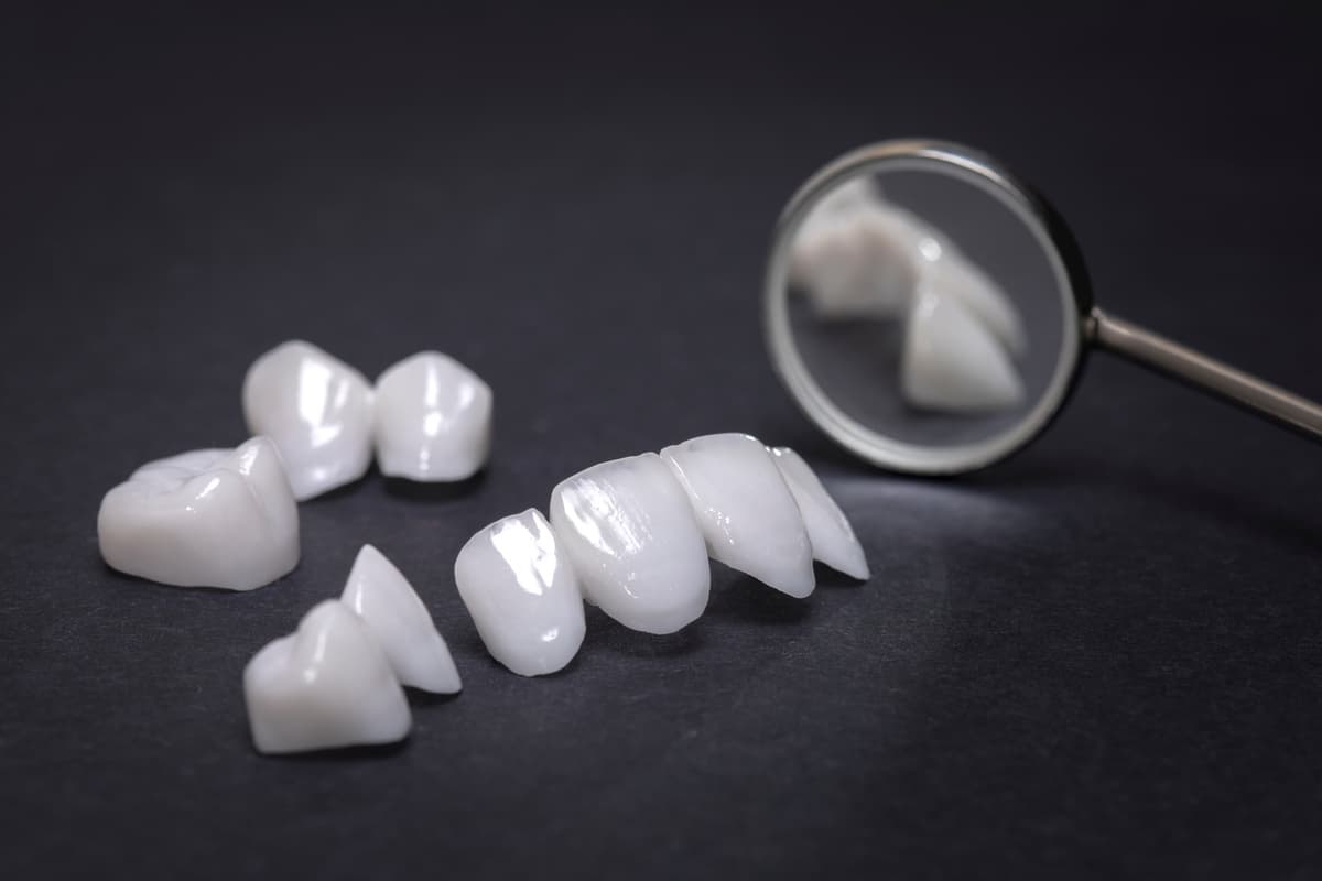 Porcelain Crowns & Bridges